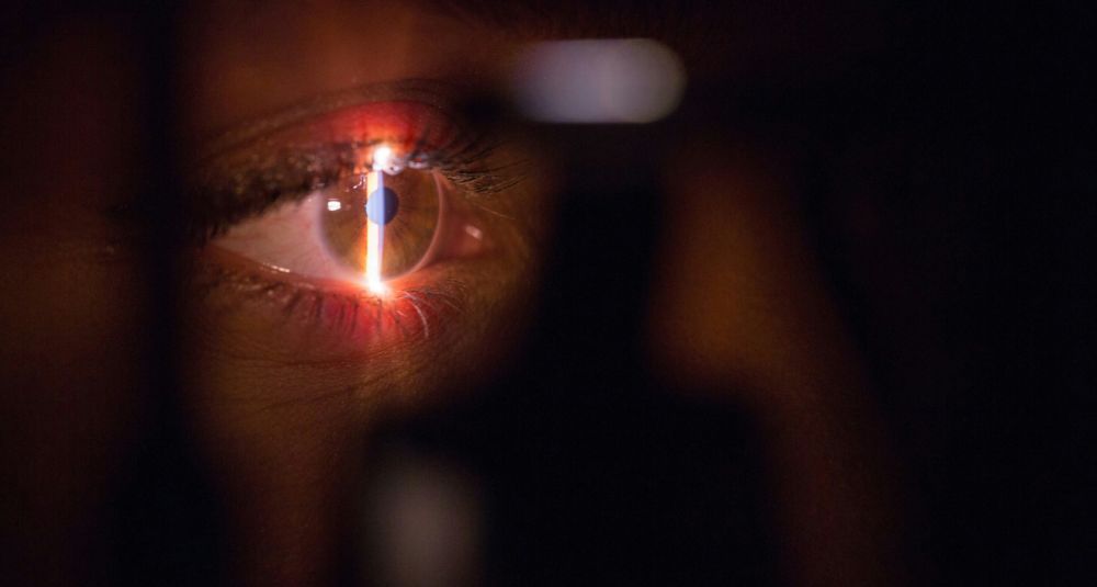 Интраокулярные линзы (ИОЛ): все об искусственном хрусталике глаза – от выбора до жизни после операции